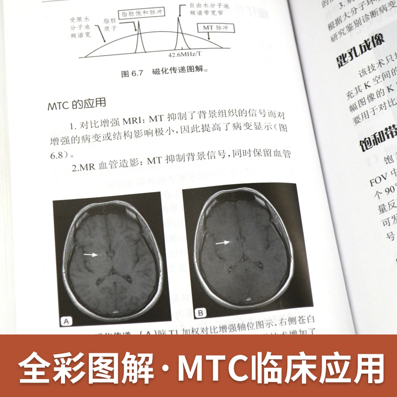 【官方直营】磁共振一点通(第2版) 磁共振诊断 国外引进中文翻译 磁共振成像技术指南 基本原理设备及应用 MRI诊断学 核磁共振书籍 - 图2