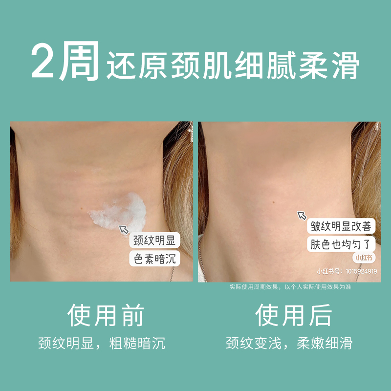 黎贝卡推荐gm澳芝曼360美提拉颈霜 GM澳芝曼海外颈霜