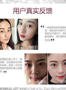 美白祛斑自然蔻贵妇膏三件套
