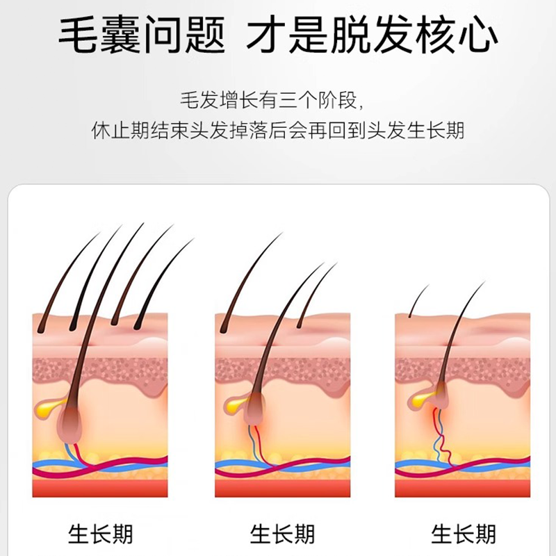 plameca西班牙小黑盒进口增发防脱护发固发养发烟酰胺锯棕榈胶囊 - 图1