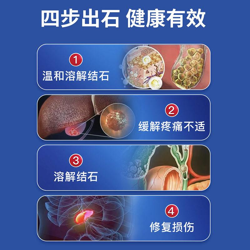 石康通德国强力消石素原装进口胆肾碎石溶化排结石专用药善清疗R