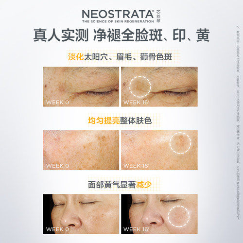 [店铺爆款]NeoStrata芯丝翠活力淡斑乳50ml美白淡斑A醇早C晚A - 图2