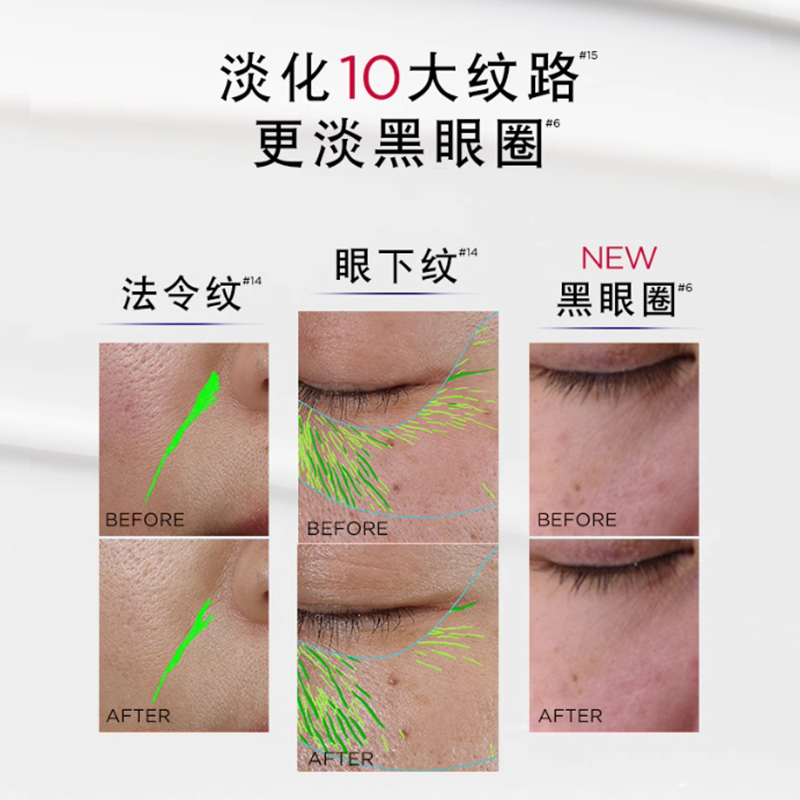 欧莱雅三代全新升级紫熨斗全脸眼霜保湿抗皱提拉紧致淡化细纹2370