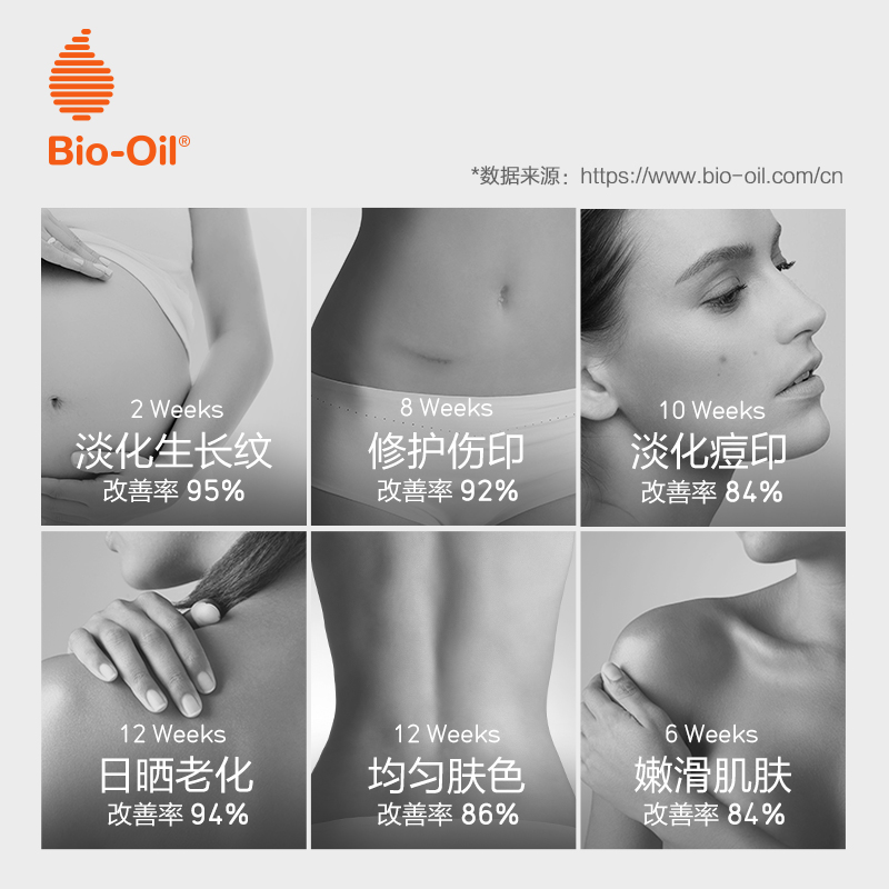 百洛旗舰店百洛妊娠期产后淡化孕妇油200ml纹干痒痘印身体按摩护肤非橄榄油0
