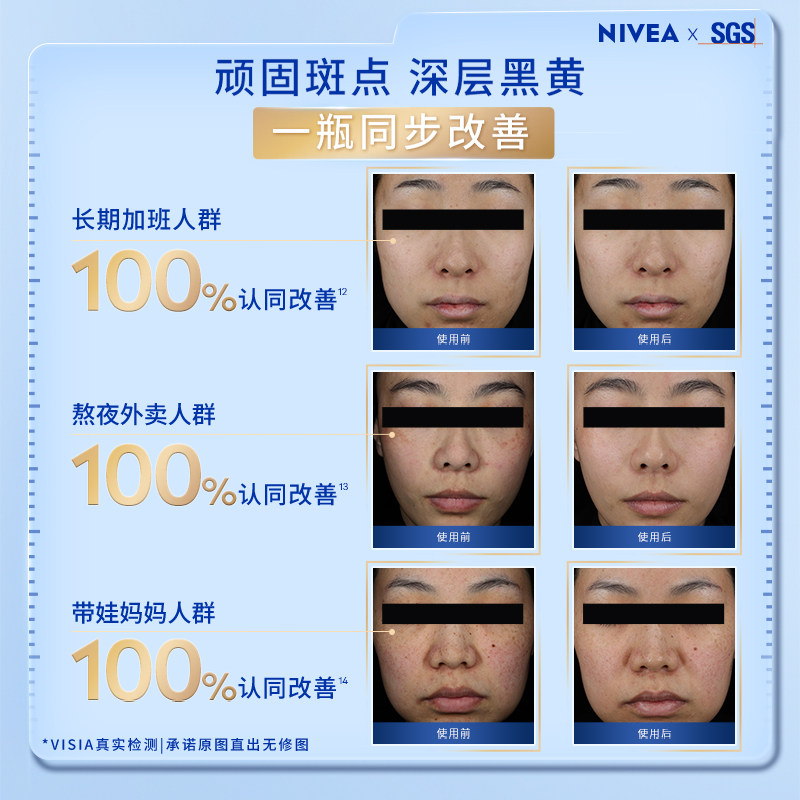 【直播间专属】妮维雅630双能瓶抑黑抗糖去黄去暗沉焕白精华50ml