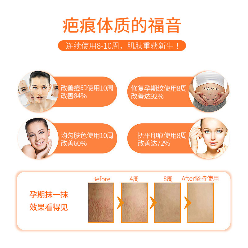 bio oil百洛油孕妇妊娠纹护肤油 Apodiscounterde海外复方精油