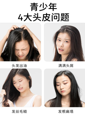 青少年去屑洗发水男孩女生专用