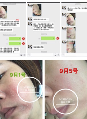 medspa美帕维生素b5保湿爽肤水