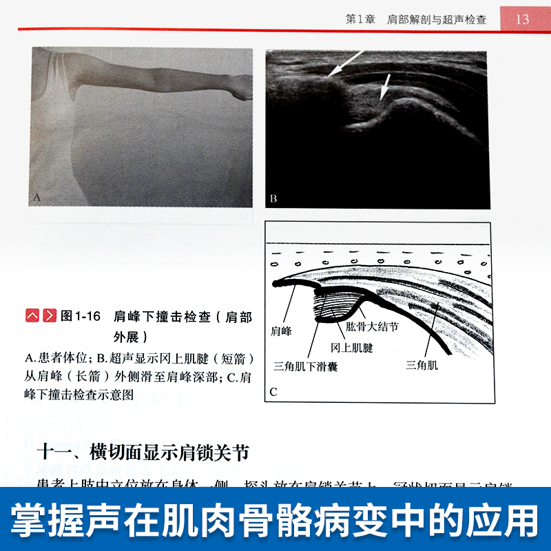 正版书四肢肌骨超声入门图解 第2版 肌肉骨骼超声入门图书 超声检查方法与技巧局部结构与解剖附有位置示意图 王月香著 科学出版社 - 图1