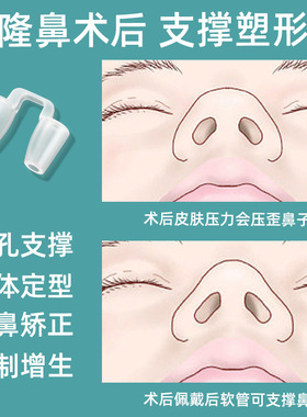 器术后支撑矫正器鼻孔撑开防变形