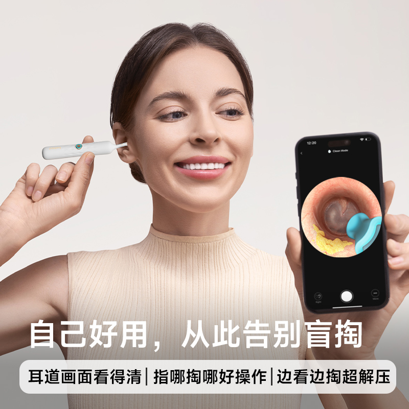 可视掏耳勺高清儿童耳朵清理神器发光带镊子耳挖勺抠扣挖耳屎工具 - 图3