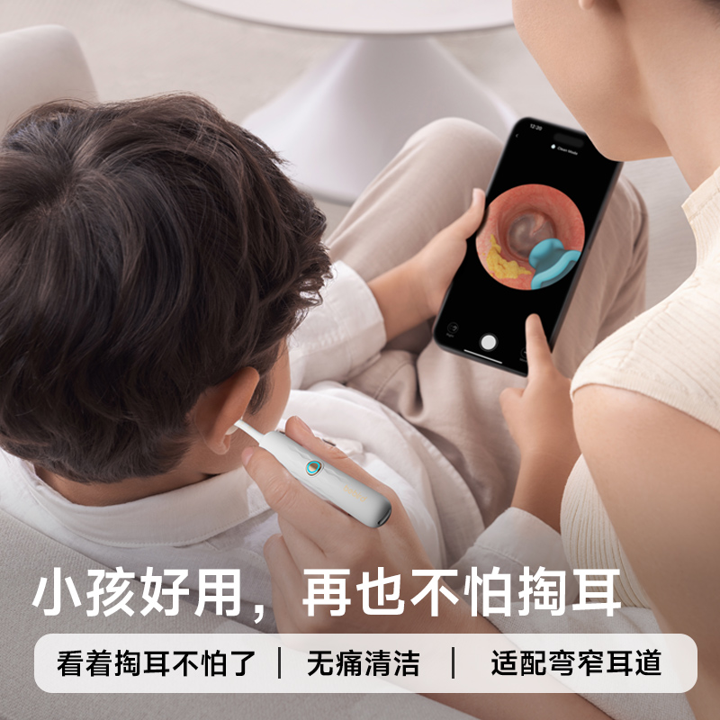 可视掏耳勺高清儿童耳朵清理神器发光带镊子耳挖勺抠扣挖耳屎工具 - 图2