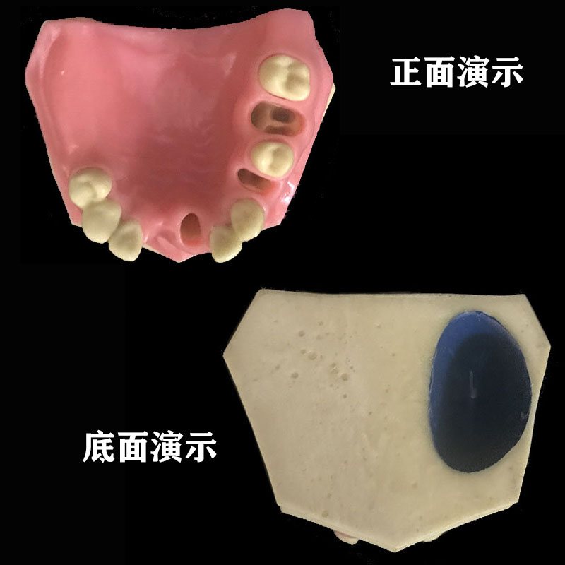 牙科材料种植模型教学练习考试牙齿牙模牙科备牙正畸病理口腔模型-图1