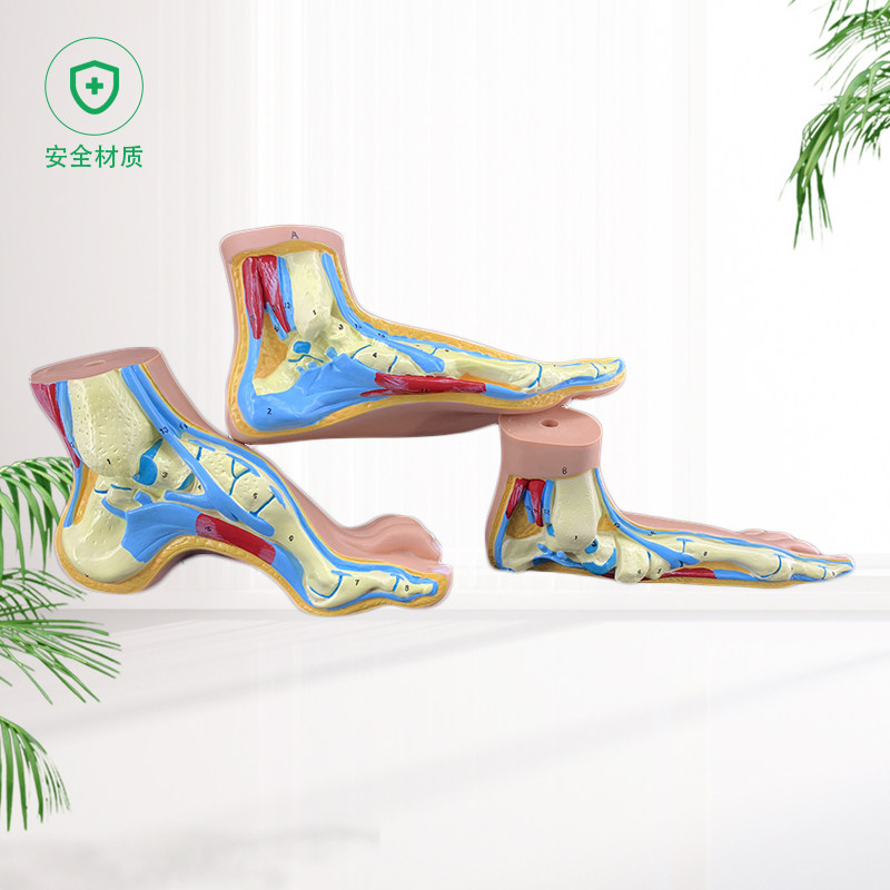 正常足弓形足高弓足模型脚关节模型爪形足脚部模型解剖医院