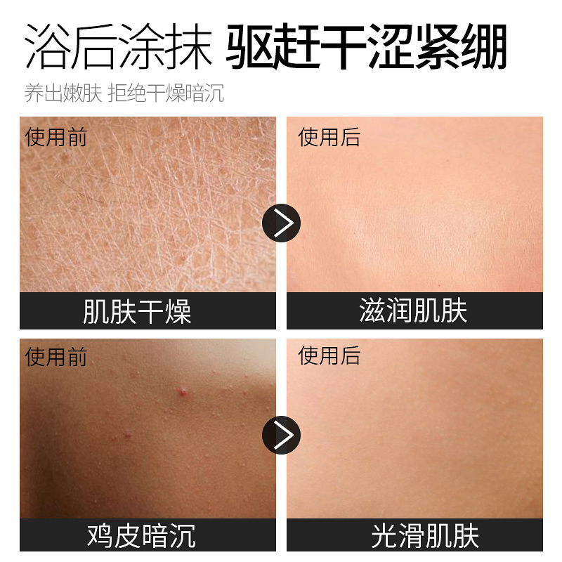 维特丝拓佳专卖店男士专用全身体乳液淡香保湿润肤露干性肤质止痒补水皮肤干燥秋冬2