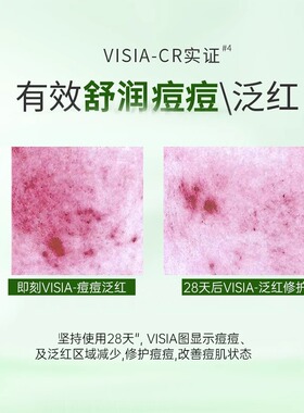 官方正品】可复美祛痘修护面膜