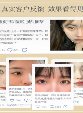 双眼皮定型霜眼皮下垂双眼皮神器无痕隐形自然工具正品买2发3