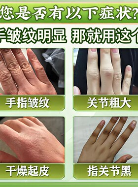 手指关节皱纹】修复护手霜嫩肤