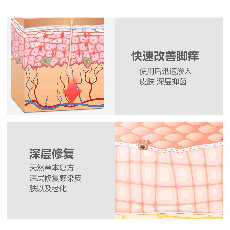 抑菌喷剂脚汗脱皮泡脚痒脚臭消毒杀菌喷雾止痒膏真菌感染脚出汗ZX-图2