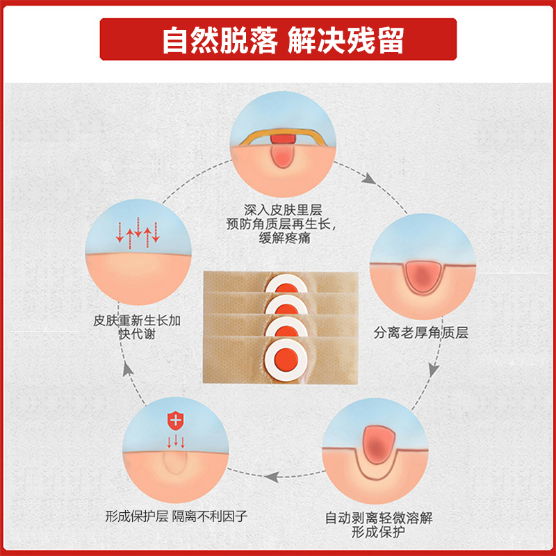 可孚鸡眼贴鸡眼膏儿童手成人手指去脚底脚趾正品脚肉刺家用6贴/盒-图2