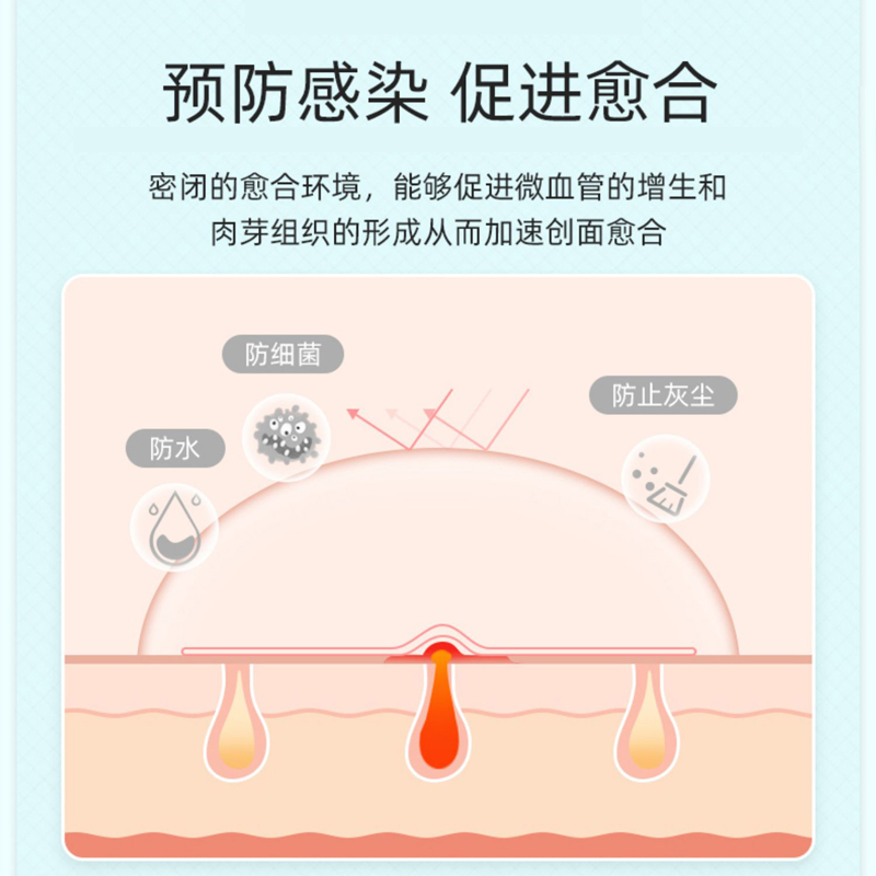 U先派样】可孚医用水胶体敷料贴人工皮痘痘贴创面无菌伤口敷贴 - 图2