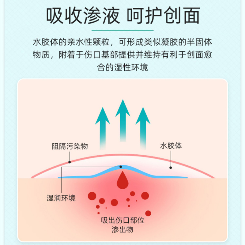 U先派样】可孚医用水胶体敷料贴人工皮痘痘贴创面无菌伤口敷贴 - 图1