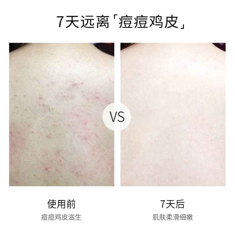 milensea旗舰店米蓝希死海沐浴盐后背部祛全身体痘海盐去鸡皮去角质磨砂膏牛奶女2