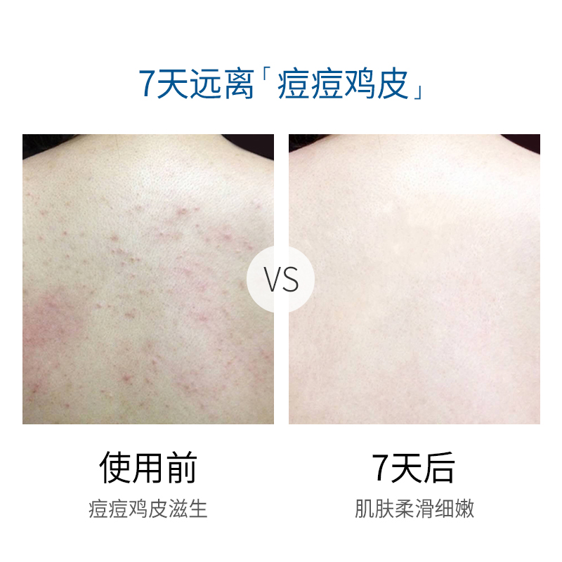 milensea旗舰店米蓝希死海沐浴盐（甜橙）全身体去角质去鸡皮女后背部祛痘泡澡盐2