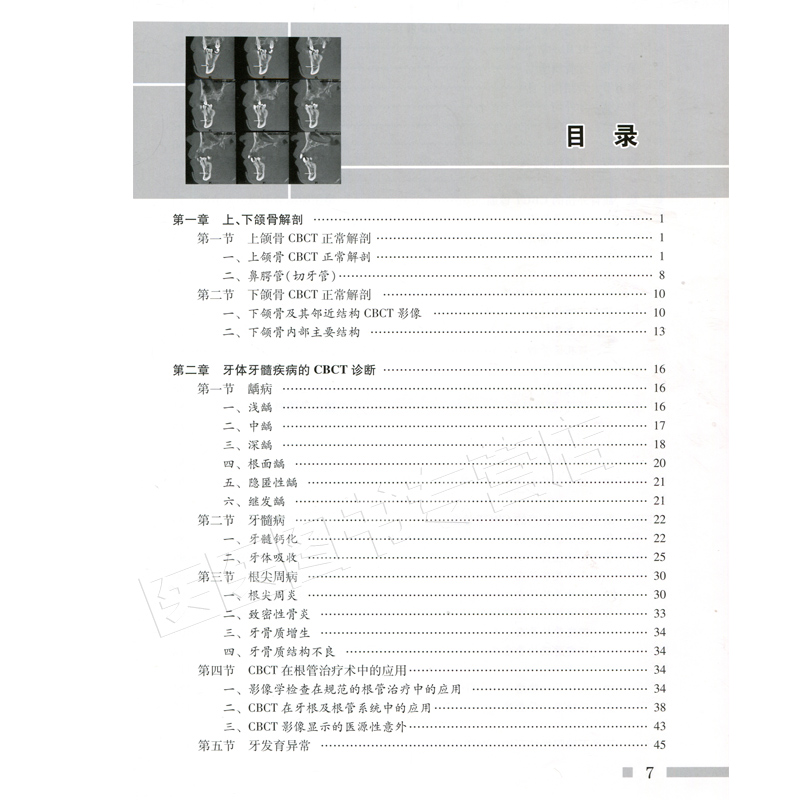 口腔临床CBCT影像诊断学人卫版牙颌面畸形功能矫形修复正畸临床技术创新阻生智齿拔除术瓷贴面微创实用牙周整形手术口腔种植影像-图1