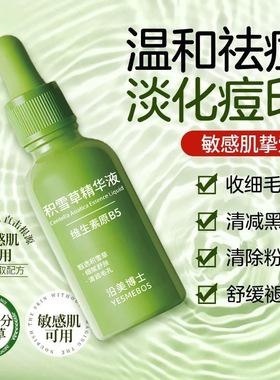 积雪草精华液修护淡化痘印泛红去闭口粉刺黑头收缩毛孔正品爆款