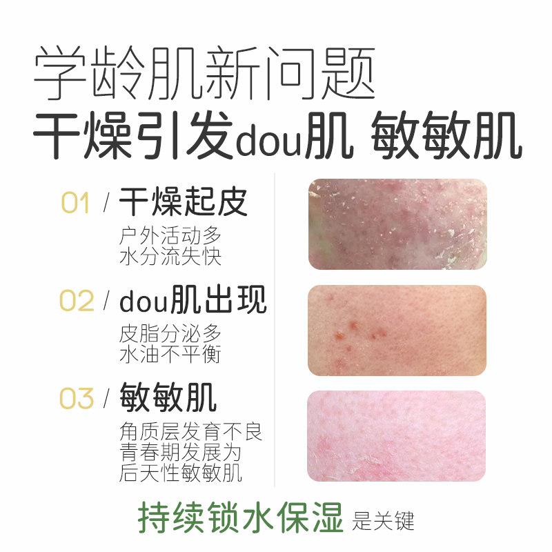 松达儿童山茶油润护霜1g*3-不支持单拍-请返回频道加购-wf1,淘宝优惠券,粉丝福利购,淘宝优惠卷