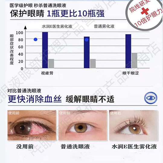 Eye atomization fluid relieves dry eye symptoms eye spray