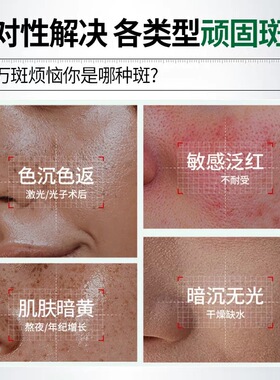 【于震代言祛斑霜】正品苣薇氨甲环酸美白祛斑修护霜博士科研淡斑