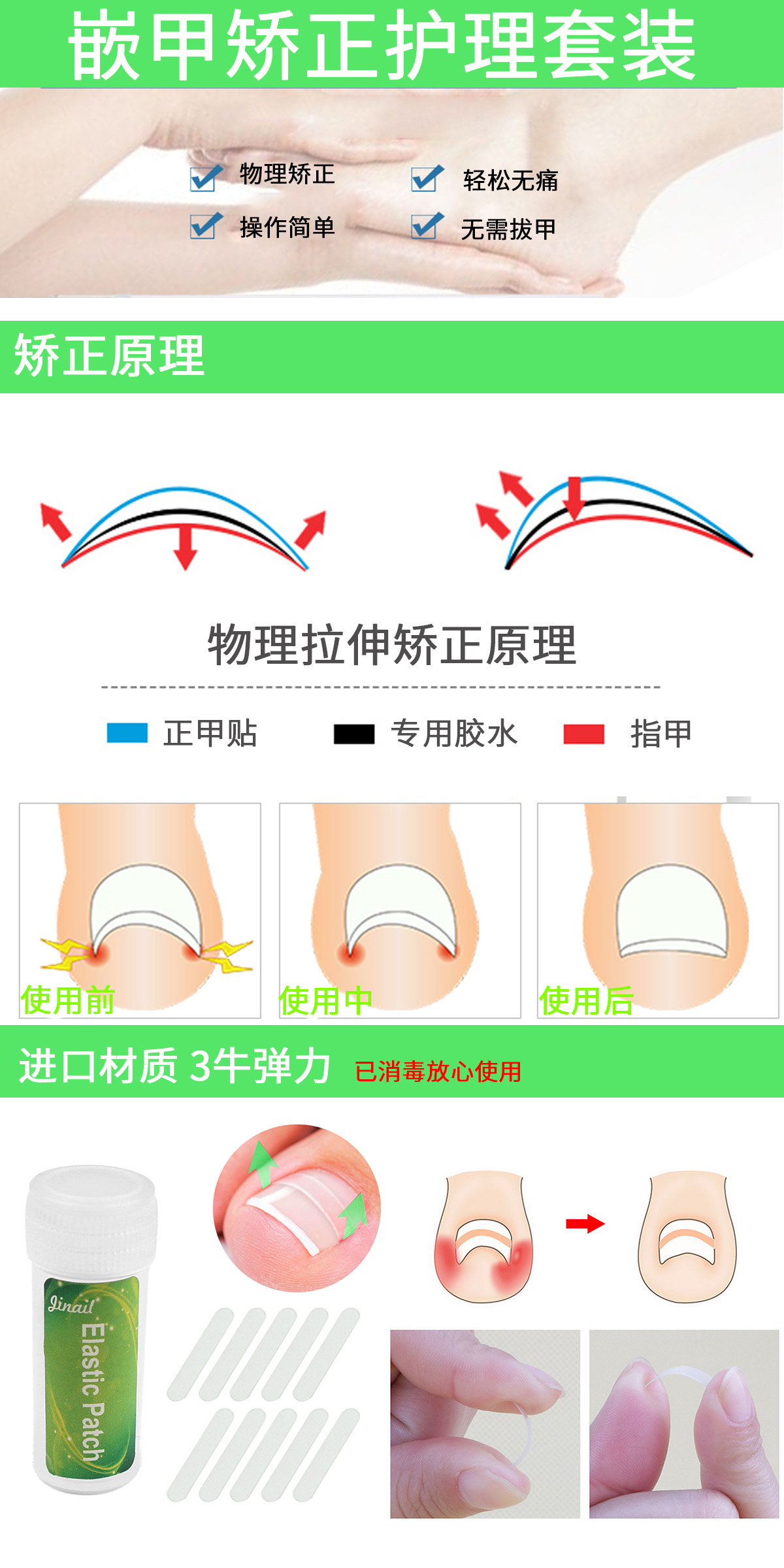 德国嵌甲贴正甲贴套装脚趾甲嵌甲矫正器纠正甲沟神器炎 拉拉贴片 - 图1