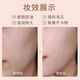 Qiukou hyaluronic acid concealer ຕິດທົນນານ BB ຄີມຫນ້າບໍ່ເອົາອອກ