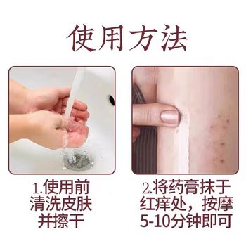 Pigmented Purpura Cream ເດັກນ້ອຍຜູ້ສູງອາຍຸຂອງຜູ້ໃຫຍ່ subcutaneous ເລືອດອອກຈຸດສີແດງ Vasculitis Henoch-Schonlein Purpura ຢາພິເສດ