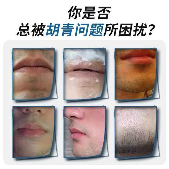 Men's beard removes black marks on beard, fades beard, removes chin without leaving black spots, lip hair and beard softening cream