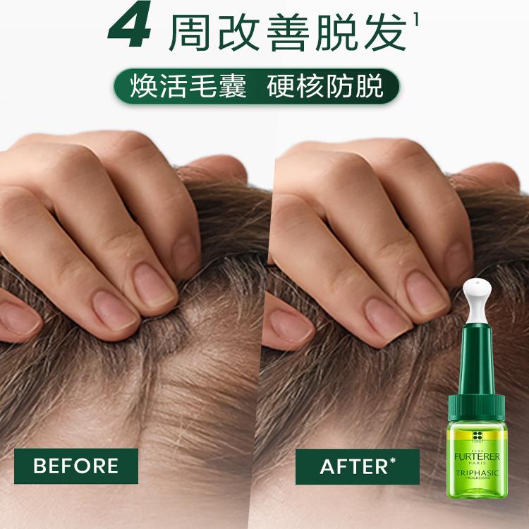 【现货立抢】馥绿德雅三相固发育发防脱头皮精华液控油丰盈蓬松