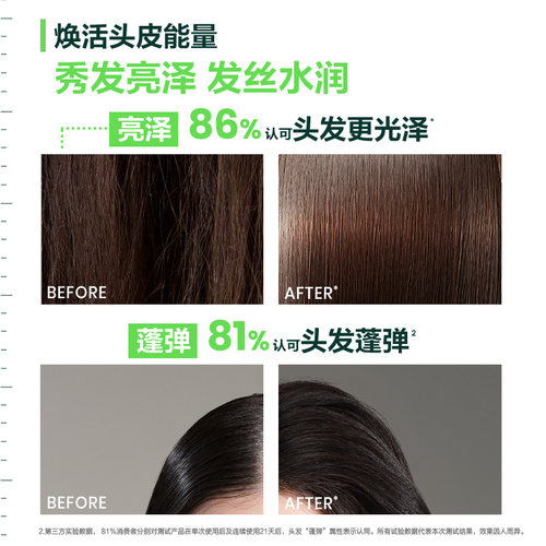 【参与618保价】馥绿德雅小粉珠洗发水植物玻尿酸强韧蓬松丰盈 - 图3