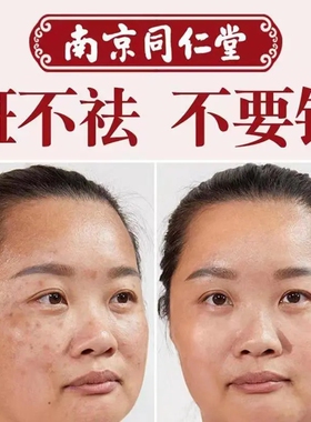 去黑色素沉淀脸部改善暗沉肤色