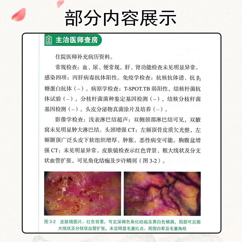北京协和医院疑难重症皮肤病自身 久久旺图书皮肤病学/性病学