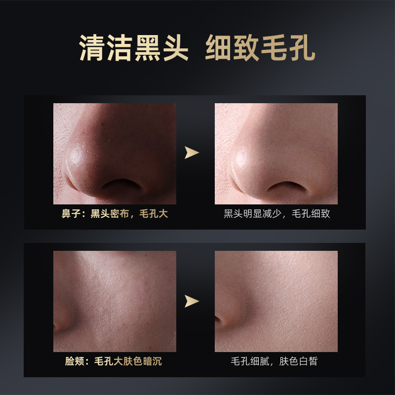和风雨男士专用撕拉面膜去黑头粉刺神器泥膜鼻贴深层清洁收缩毛孔
