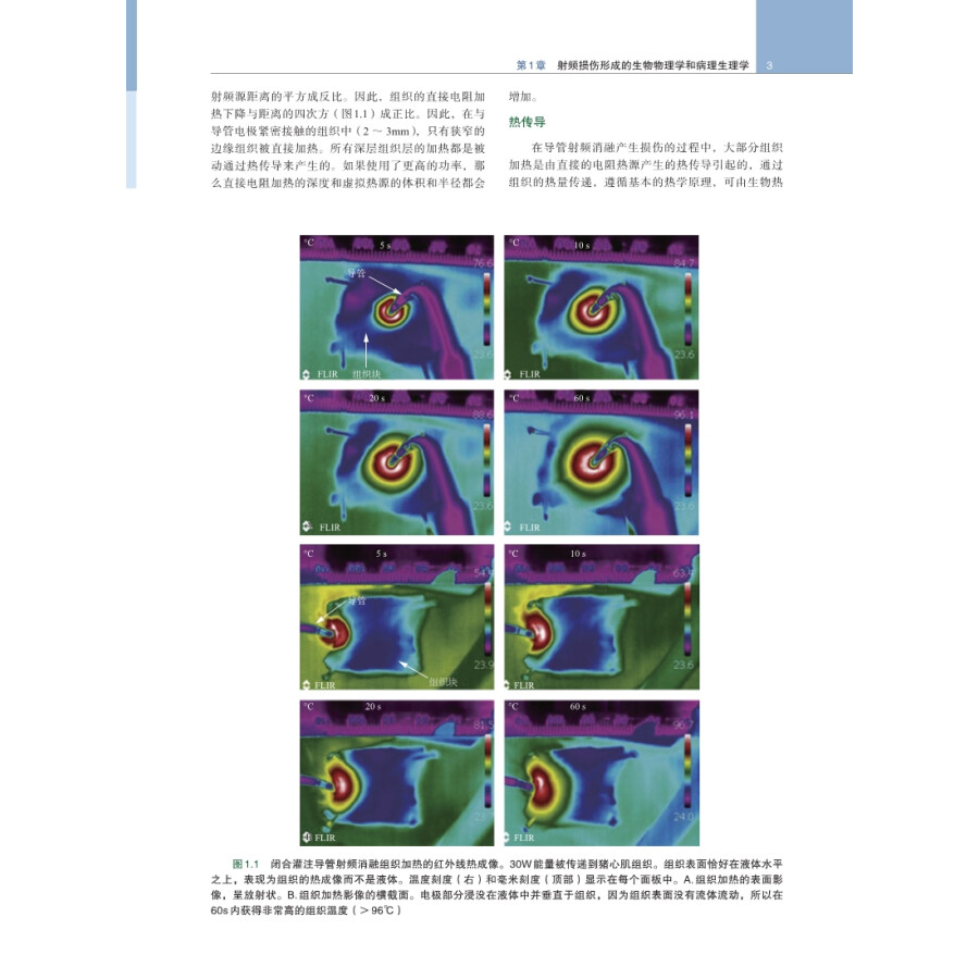 现货心律失常导管消融中文翻译版原书第四版详述经导管能量传输的基本概念内科学书籍陶凌等主译9787030683670科学出版社-图3