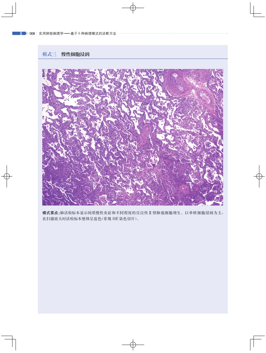 实用肺部病理学基于6种病理模式的诊断方法史景云易详华累及肺部胸膜肿瘤性病变全面总结病理学诊断影像CT上海科学技术出版社-图3