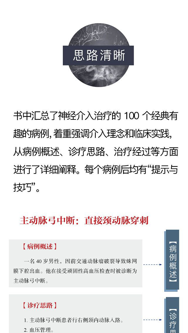 100个有趣的神经介入病例 提示与技巧 神经病学手术治疗病例动脉瘤神经 外科学书 郭庚 等译9787504694645中国科学技术出版社 - 图2