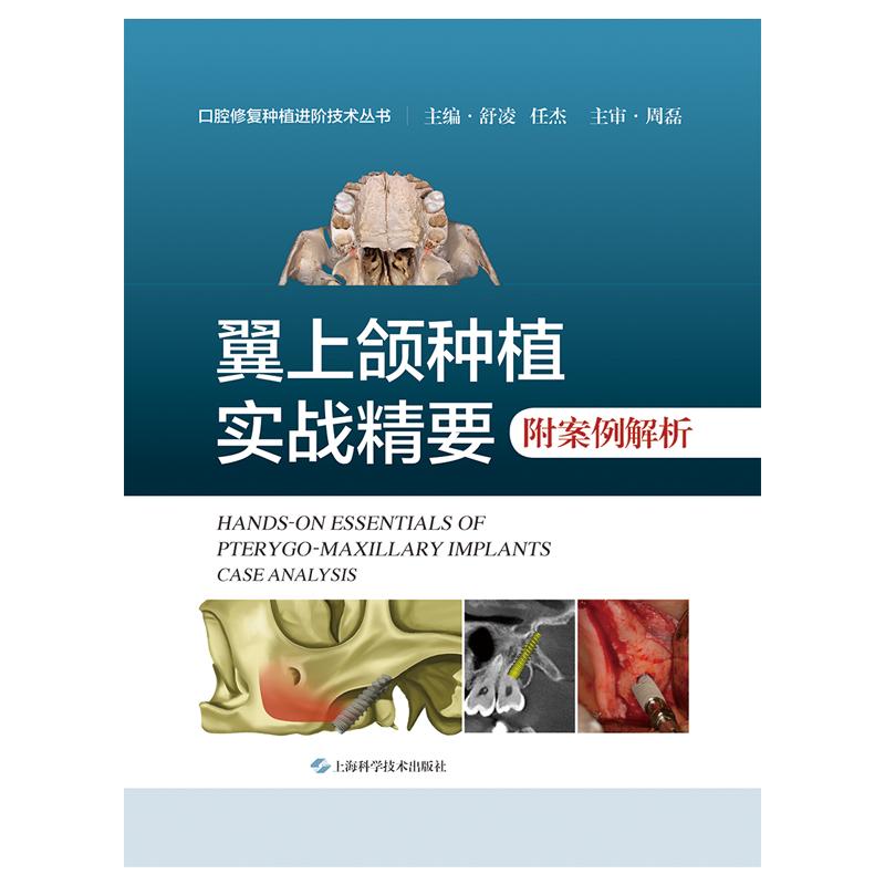 翼上颌种植实战精要附案例解析 舒凌 任杰 适合口腔种植科医师阅读 上颌磨牙区垂直骨高度不足 上海科学技术出版社 9787547865705