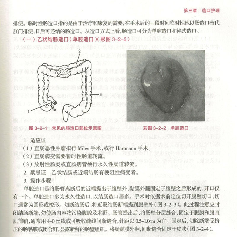 伤口造口失禁专科护理 王泠 胡爱玲主编 中华护理学会 专科护士培训教材 护理专业规范培训教材护士培训教材书籍人民卫生出版社