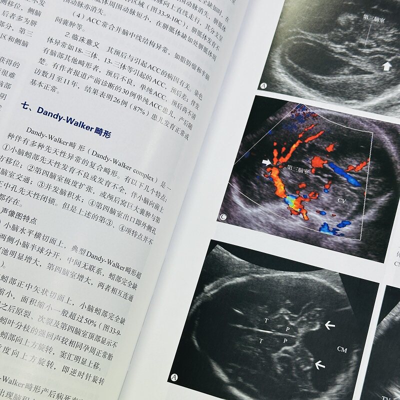 超声医学 第7七版 上下册 唐杰郭万学 2025新版 科学出版社 超声医师专业书参考工具书超声医学基础诊断治疗报告书写规范