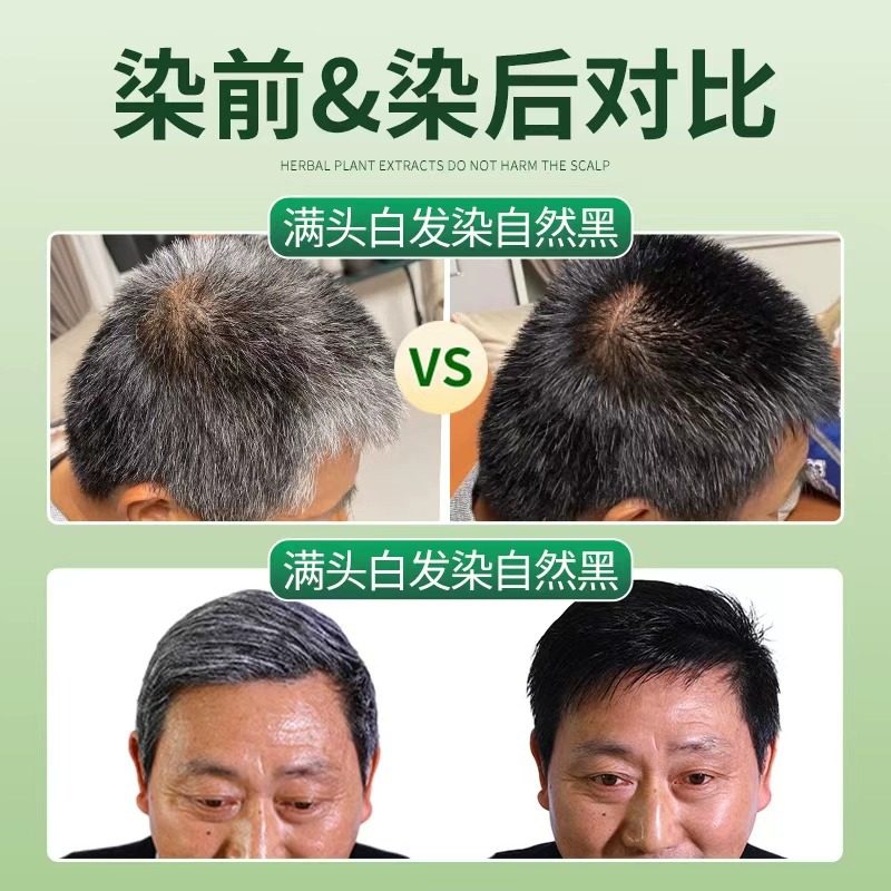 染发膏男士专用不沾头皮天然植物染发梳剂一梳黑官方旗舰店正品纯,淘宝优惠券,粉丝福利购,淘宝优惠卷