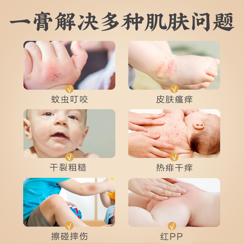 马应龙紫草膏驱蚊宝宝止痒神器消包 马应龙止痒膏